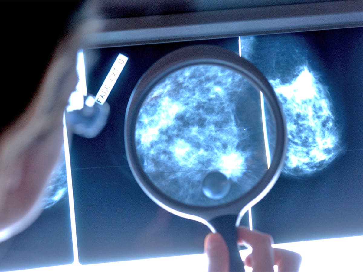 breast-cancer-rates-up-90pc-since-1971-the-independent-the