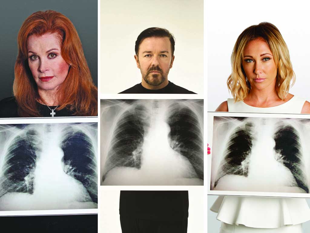Actress Stefanie Powers, left, who had lung cancer, is backing the campaign, as are Ricky Gervais and Jenny Frost, who lost their mothers to the disease