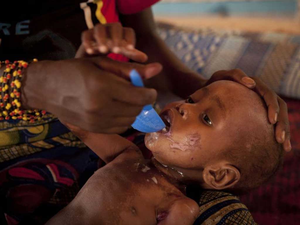 <b>Niger</b>:Charities warn that more than one
million children are at risk of severe
malnutrition across West Africa, and
are urging G8 leaders to step in to
save them.
But for some, it is already too late.
Two-year-old Issia Saidou (pictured) was brought to a Save the
Children clinic in Niger, suffering
from dysentery. His mother, Mariama
Tsahirou, was desperate to save her
son after the deaths of four of her
eight children. But despite more than
three weeks of treatment, doctors
could not save the boy: he died of
complications related to severe
malnutrition on 6 May