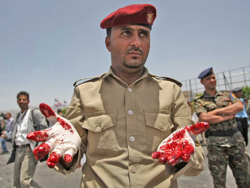 A policeman’s bloody gloves after collecting evidence at the scene