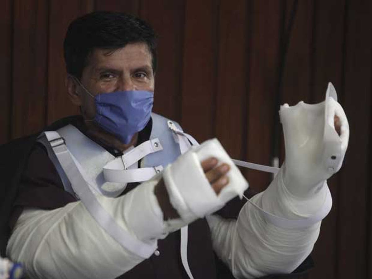 Mexican father Gabriel Granados given double arm transplant | The
