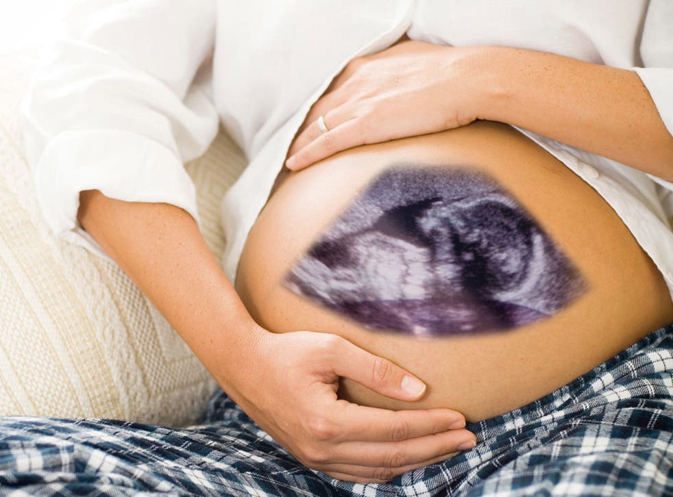 'Sonogram art' - photoshopping the scan over the stomach of the mother and uploading it to facebook - is apparently the next best thing for soon-to-be parents