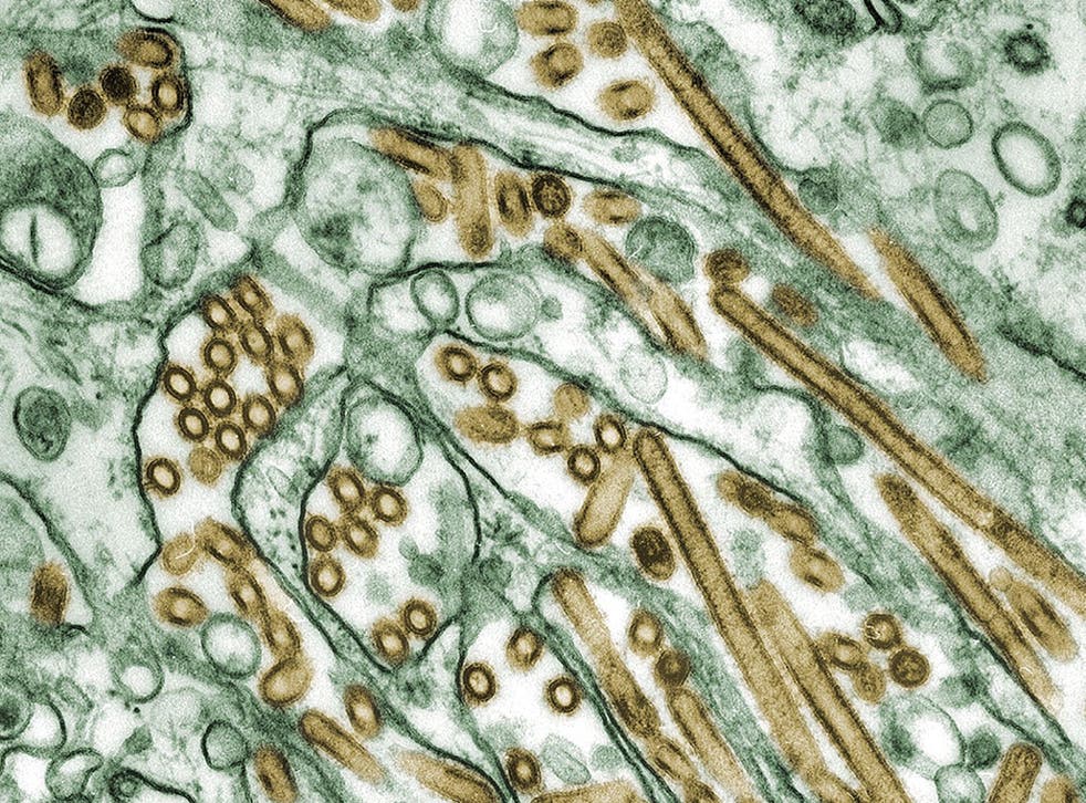 Colorized transmission electron micrograph of avian influenza A H5N1 viruses (seen in gold) grown in Madin-Darby canine kidney (MDCK) cells (seen in green)