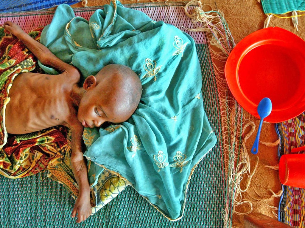 A malnourished infant in Maradi, Niger, which is suffering high food prices and low harvests