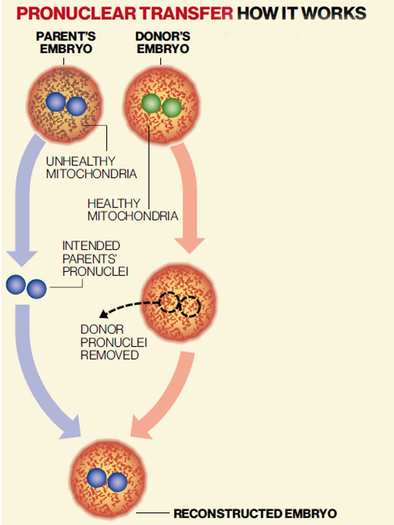 There are two ways of treating families with mitochondrial disease
so that it is not passed from mother to daughter. Shown here, the nucleus from the parent’s embryo, which is surrounded by unhealthy mitochondria from the mother’s egg, is transferred into