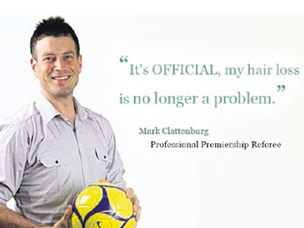 Mark Clattenburg promoting the benefits of hair restoration