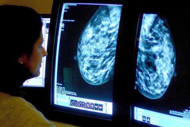Breast cancer screening leads to thousands of women undergoing unnecessary treatment despite saving lives, according to an independent review