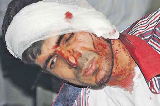 An injured man receives treatment following the blast yesterday
