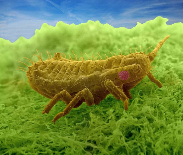 <p>An aphid </p>