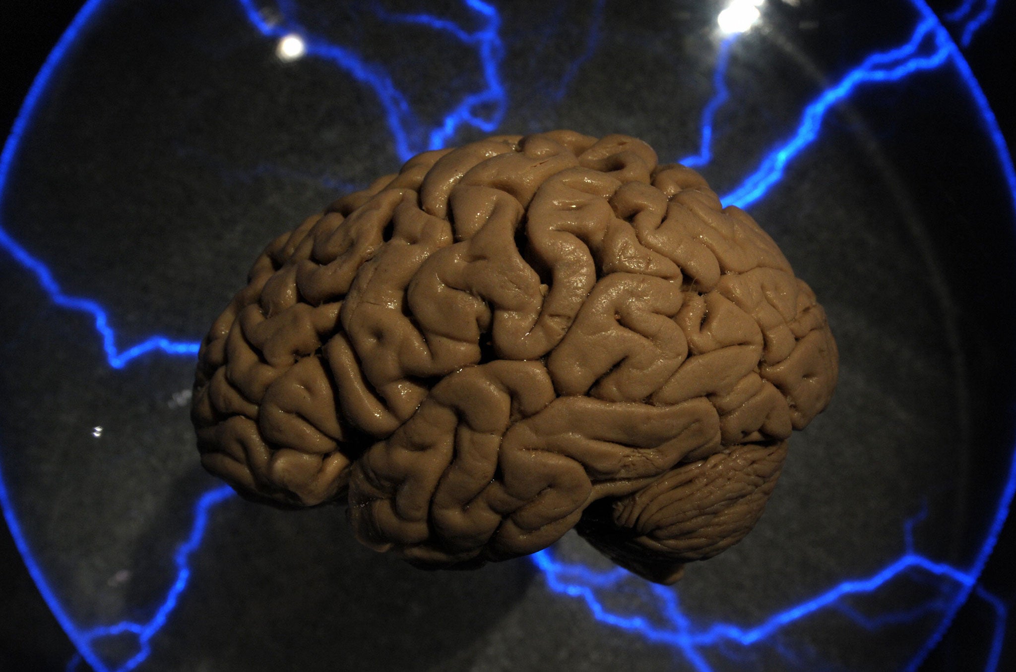 An actual human brain displayed inside a glass box, as part of an interactive exhbition 'Brain: a world inside your head', in Sao Paulo, Brazil, on August 21, 2009
