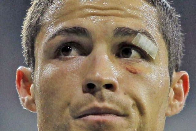 Cristiano Ronaldo returns to Manchester this week, but there is
pain in Spain for the still under-appreciated Ronaldo