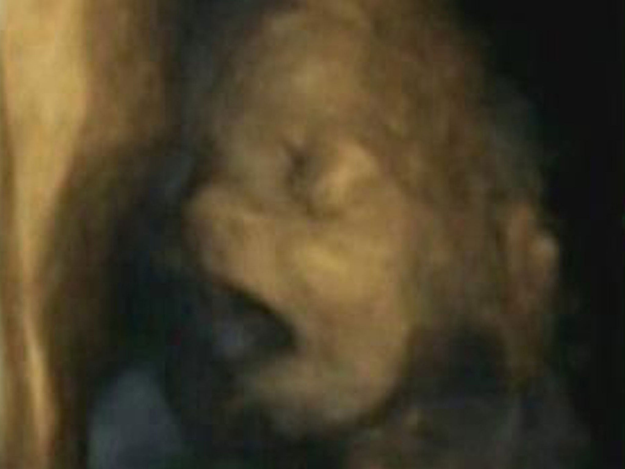 A 4D ultrasound scan shows a foetus yawning in the womb at 24 weeks