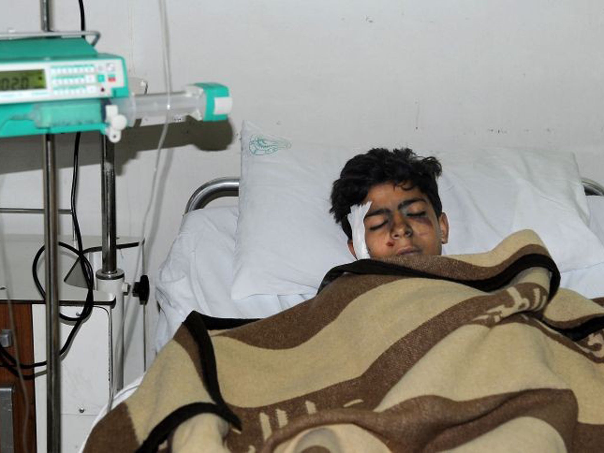 In this photo released by the Syrian official news agency SANA, an injured Syrian student lies at a hospital bed after he was wounded when a mortar hit the al-Batiha school in al-Wafideen camp
