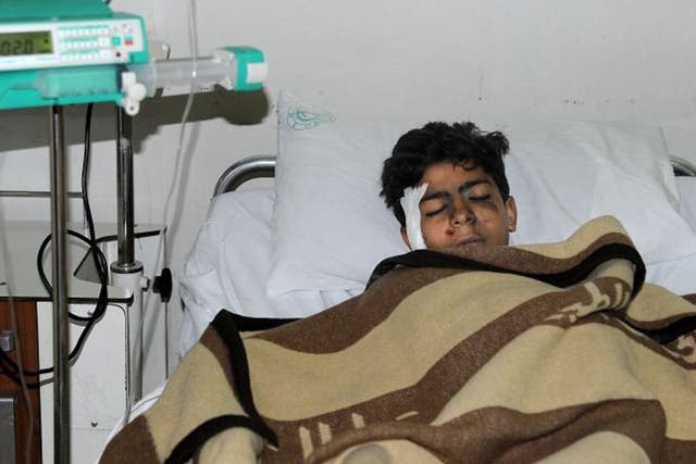 In this photo released by the Syrian official news agency SANA, an injured Syrian student lies at a hospital bed after he was wounded when a mortar hit the al-Batiha school in al-Wafideen camp