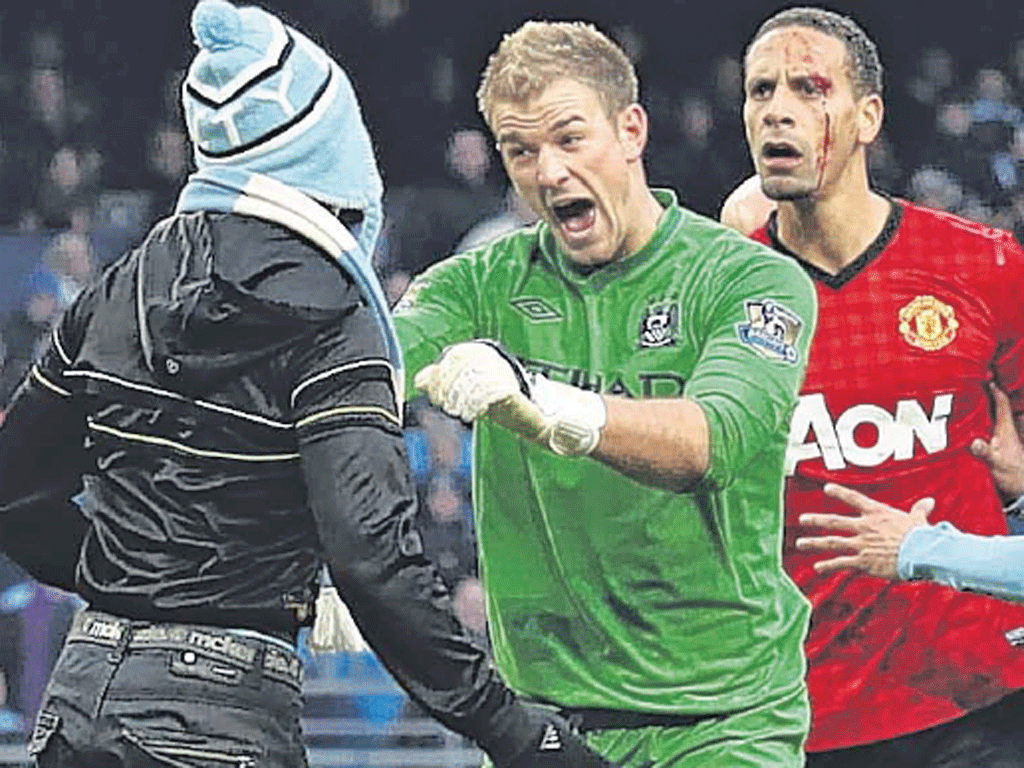 Joe Hart protects a bloodied Rio Ferdinand from a pitch invader