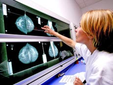 Cancer rates in women to increase six times faster than men