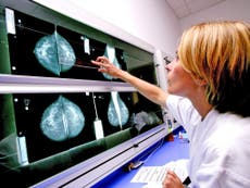 Medical breakthrough could help thousands in UK living with an aggressive type of breast cancer