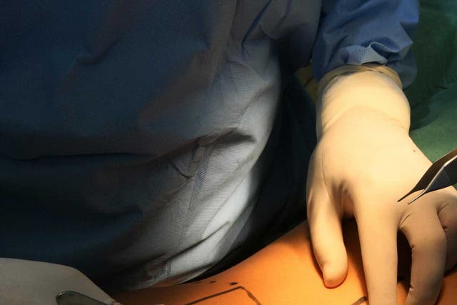 Dark and sad, but not the end: plastic surgery procedure
