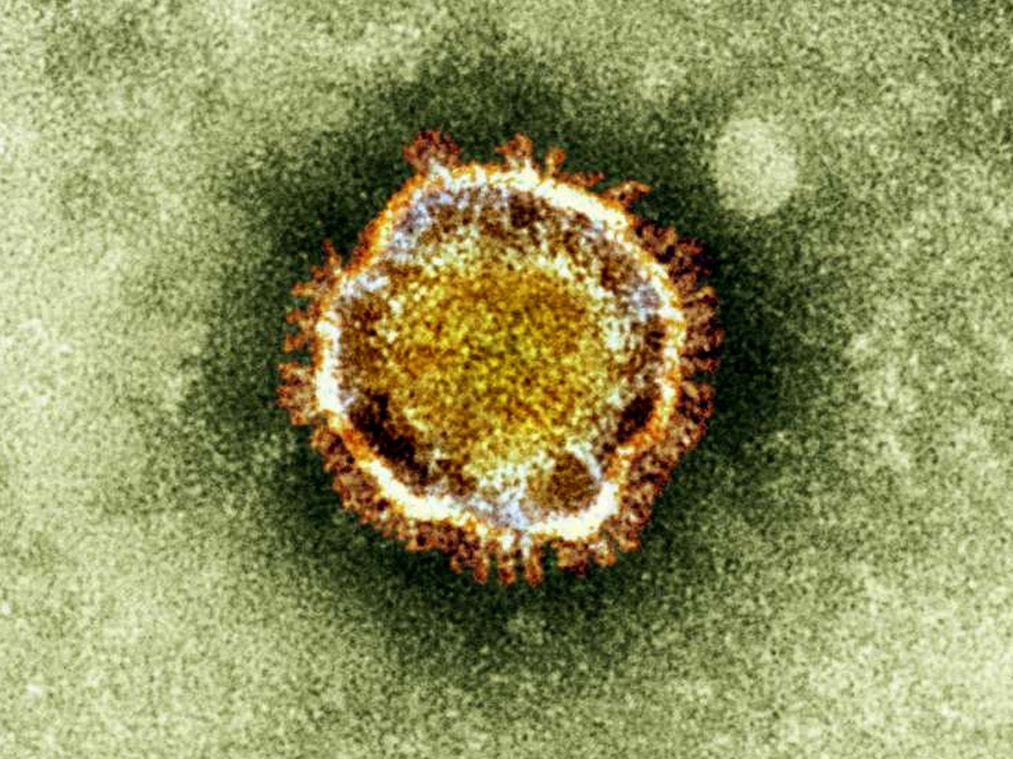 Coronavirus was the official cause of the Sars virus, which caused hundreds of deaths in 2003, said the WHO