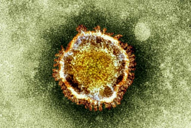 Coronavirus was the official cause of the Sars virus, which caused hundreds of deaths in 2003, said the WHO