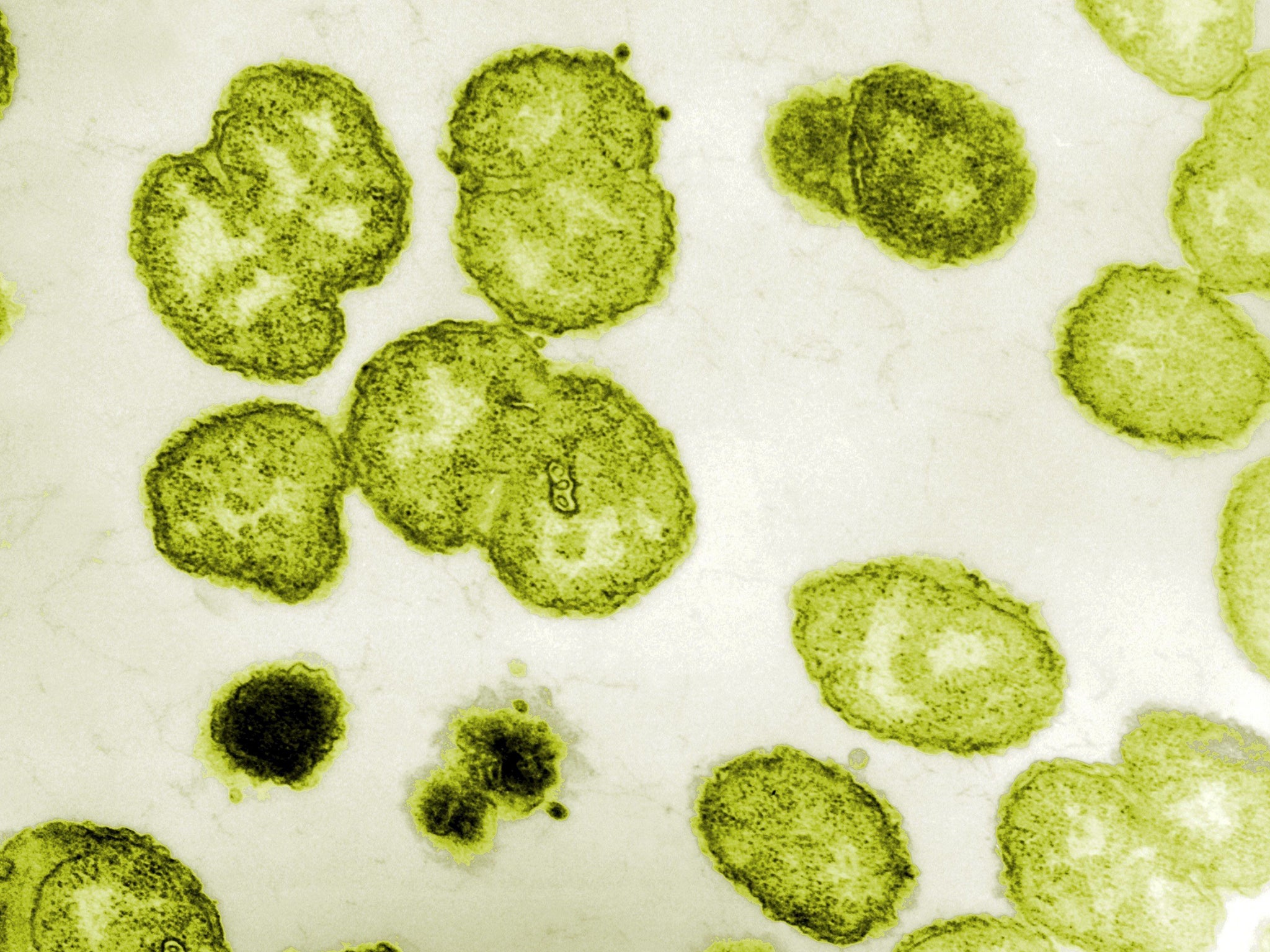 Electron micrograph of Neisseria gonorrhoeae, the aerobic Gram-negative bacterium responsible for the Sexually transmitted infection