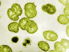 Gonorrhea cases soar as STI gets more resistant to treatment