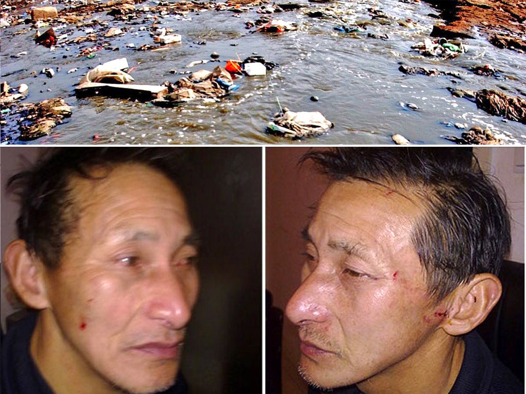 Chen Zuqian shows his injuries after the attack. His protest was to highlight the state of China’s rivers, above – one-fifth of which are so polluted the water is too poisonous for human contact