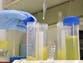 New ‘innovative’ urine test that can detect cancer early could be on NHS within years
