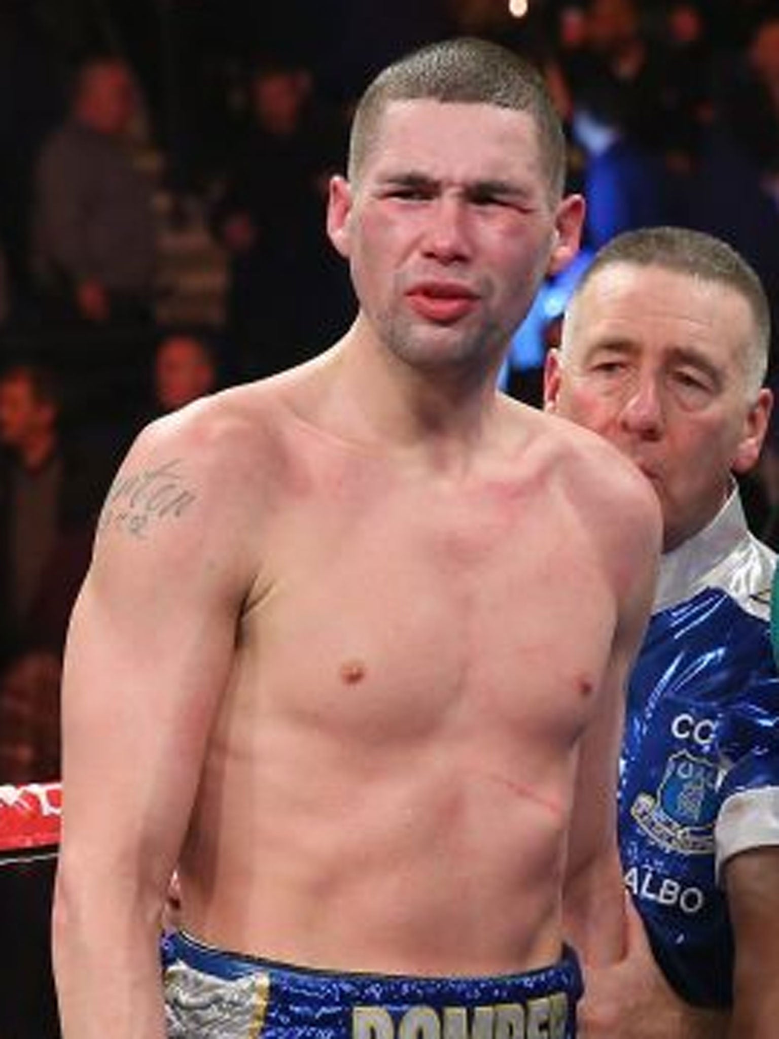 Tony Bellew admitted easing off on his opponent midfight