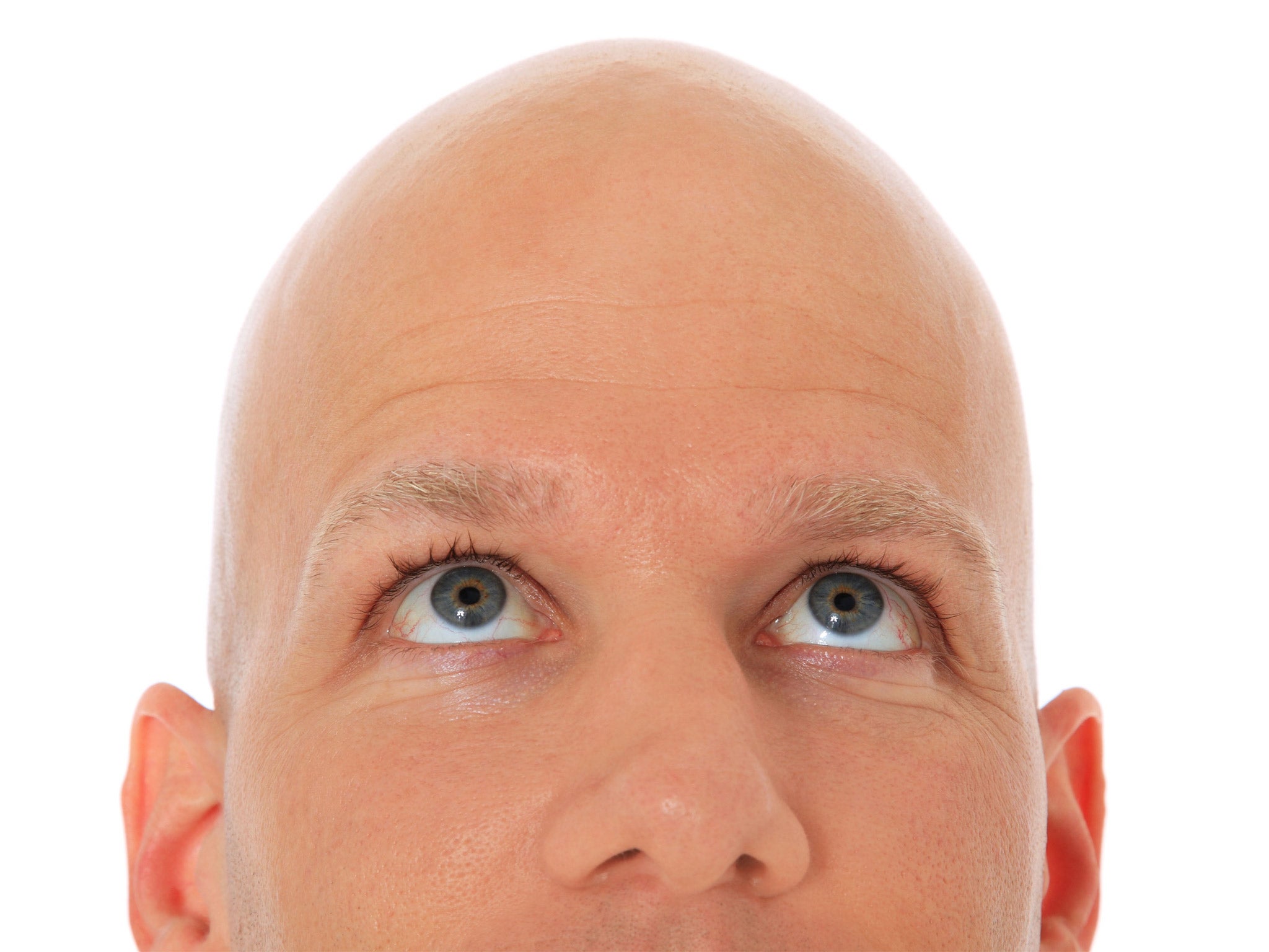 The bald facts: hair loss could be the first sign you have heart disease |  The Independent | The Independent