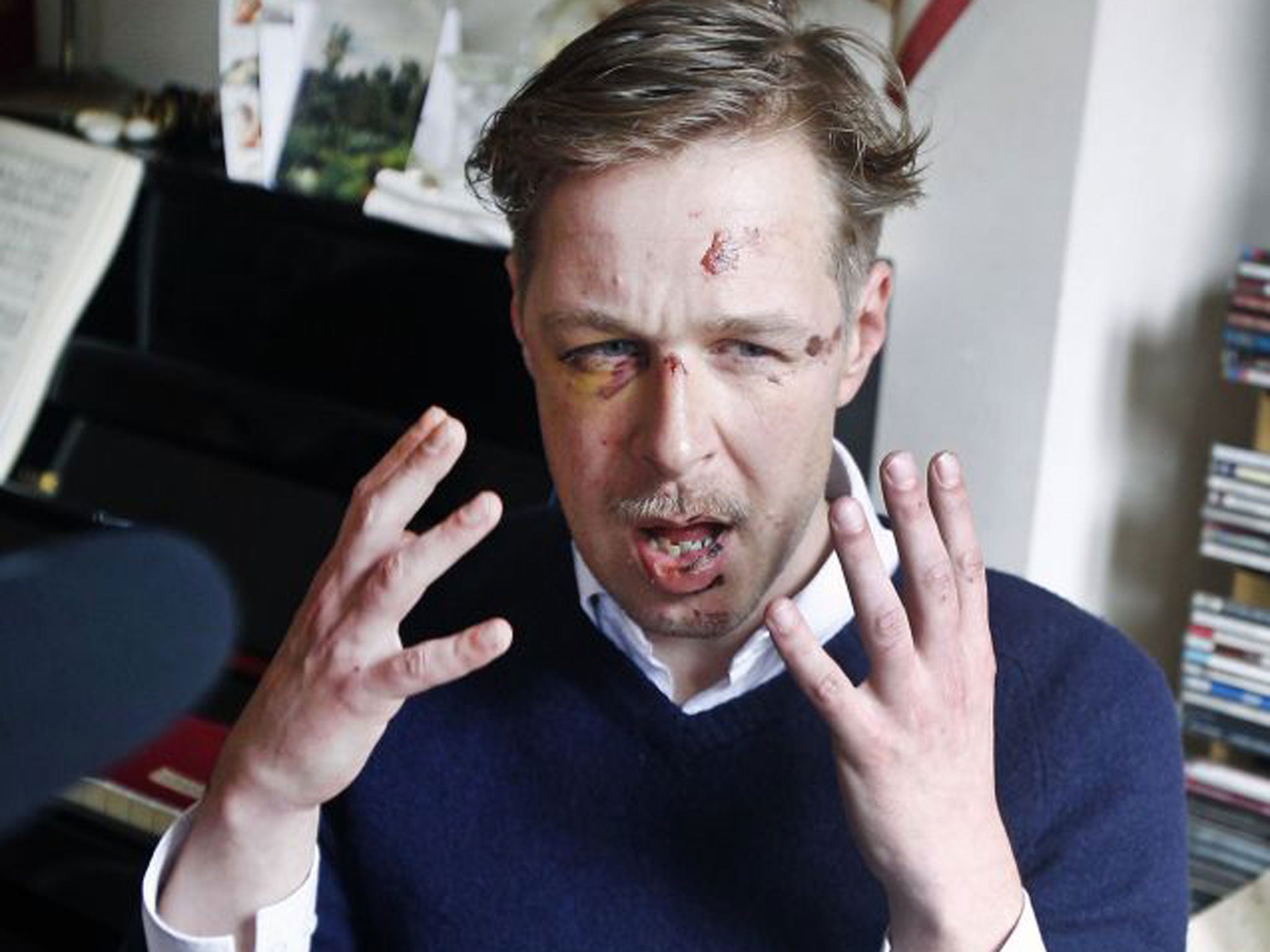 An image of Wilfred de Bruijn’s battered face has gone viral