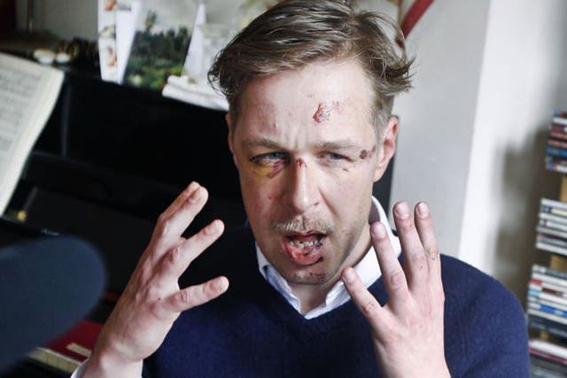 An image of Wilfred de Bruijn’s battered face has gone viral