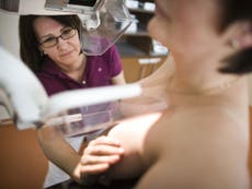 Breast cancer screening levels at lowest level for a decade