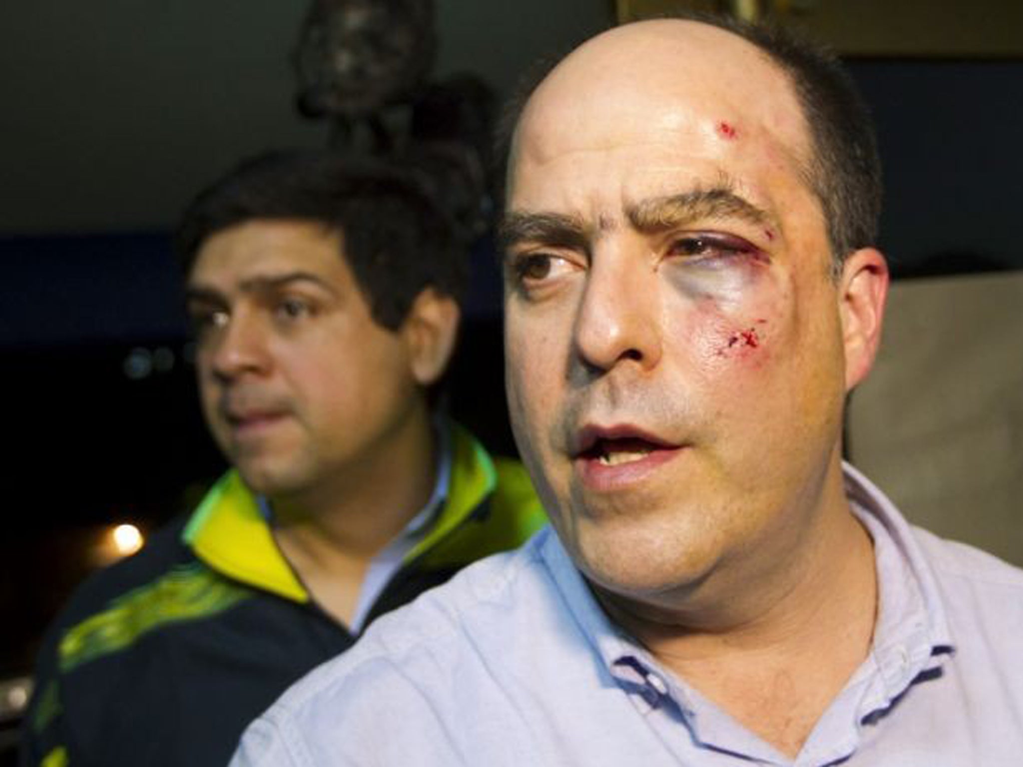 Venezuelan opposition politician Julio Borges of the Primero Justicia party was left cut and bruised after the brawl