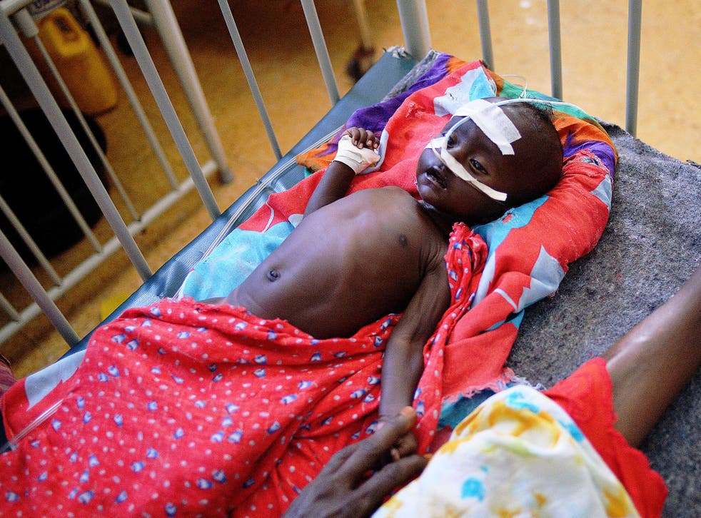 A malnourished Somali baby at the Banadir hospital in Mogadishu. Almost 260,000 Somali people, half of them children, died of dire hunger from 2010 to 2012, greatly more than was feared at the time