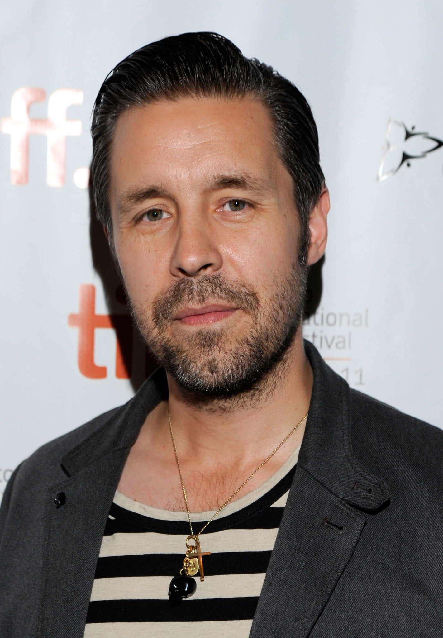 Actor Paddy Considine has been diagnosed with a rare condition that makes him sensitive to light