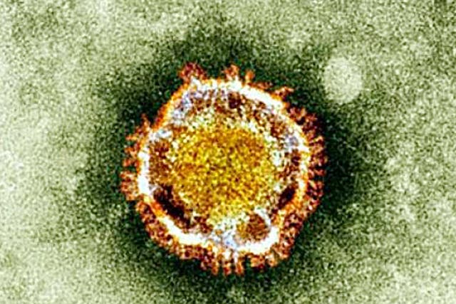 The Coronavirus seen under an electron miscroscope