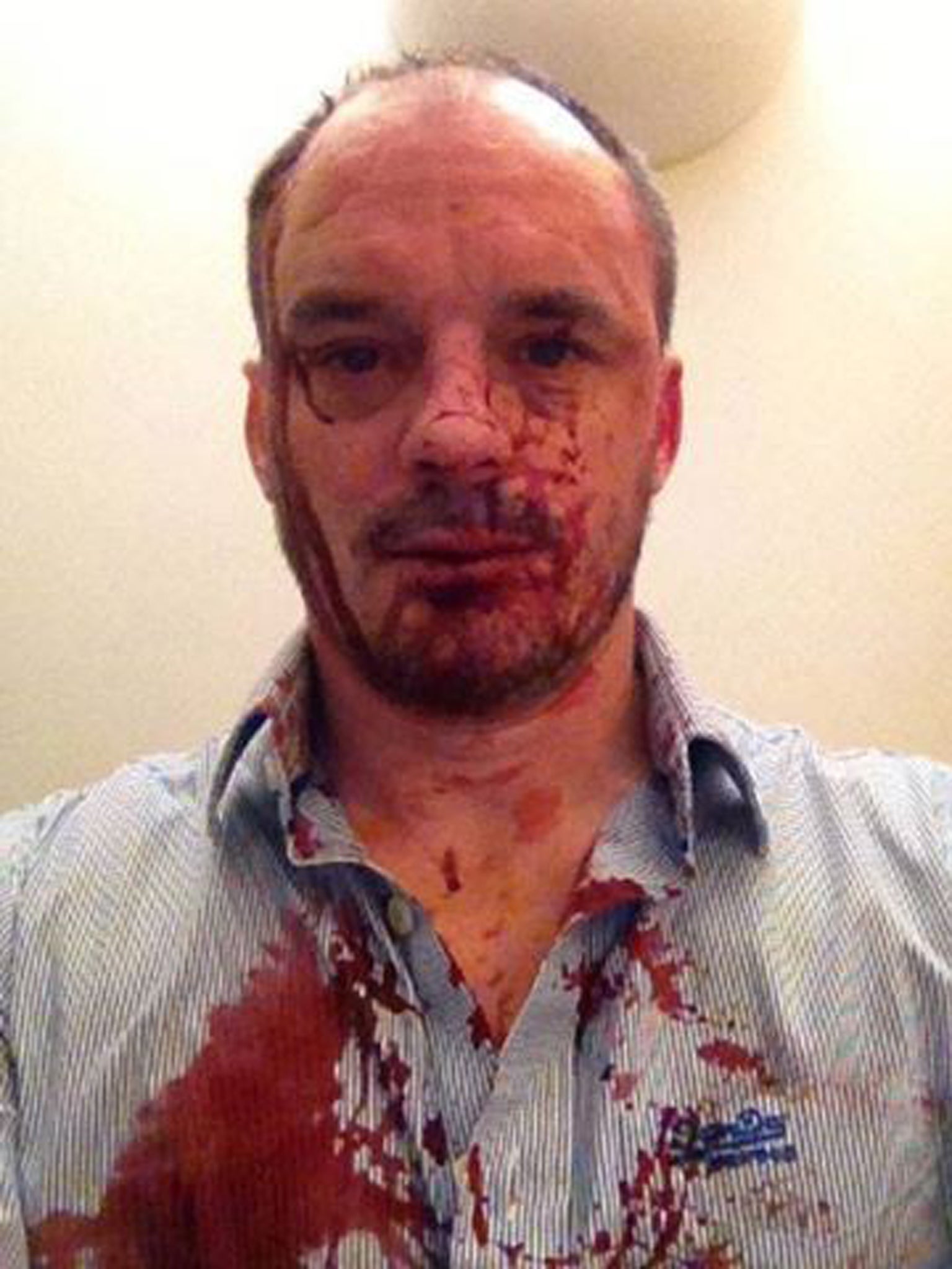 Christopher Bryant, editor of gay and lesbian online magazine Polari, was on his way home from his birthday celebrations with partner Damon Truluck when they were confronted and beaten by a group of six men on Saturday night