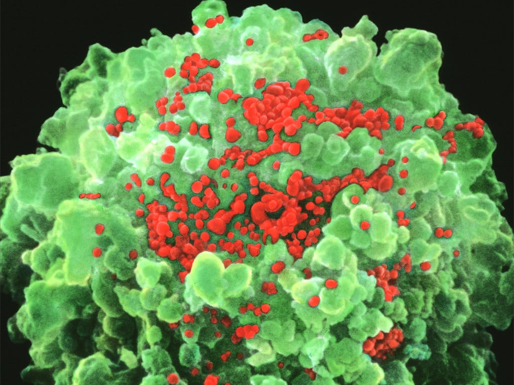 Electron microscope image of the HIV virus