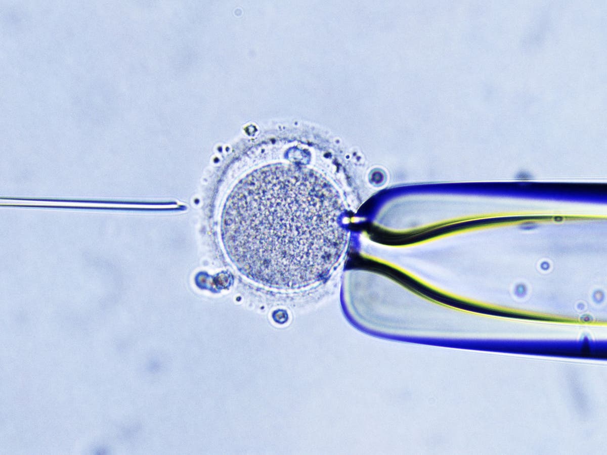 In vitro fertilization это. Оплодотворение ин Витро. Оплодотворение in vitro эко. Инсеминация in vitro. In vitro животных.