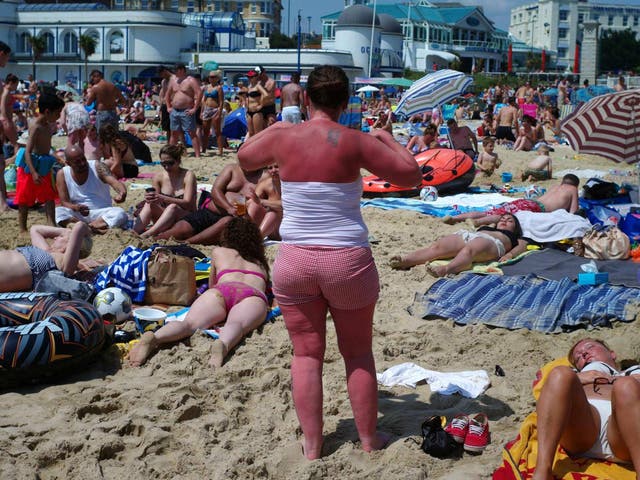 Sunburn can increase the risk of developing melanoma, the deadly form of skin cancer 