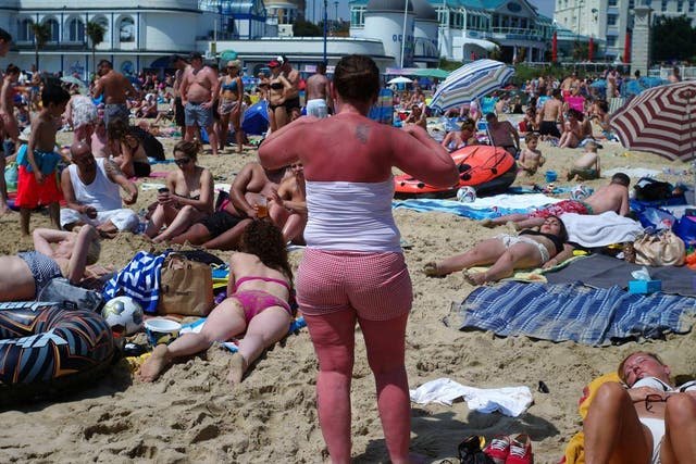 Sunburn can increase the risk of developing melanoma, the deadly form of skin cancer 