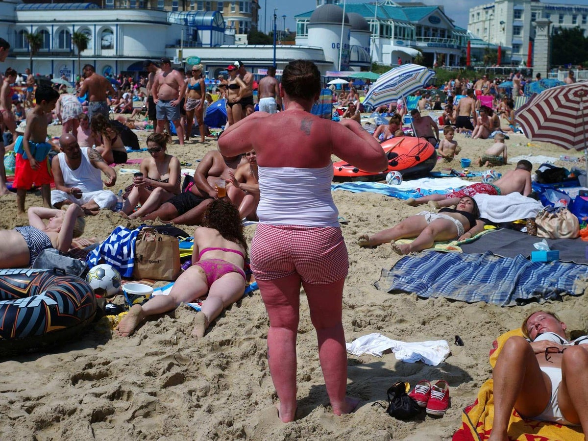 How to check if you have skin cancer: Symptoms and signs to look out for