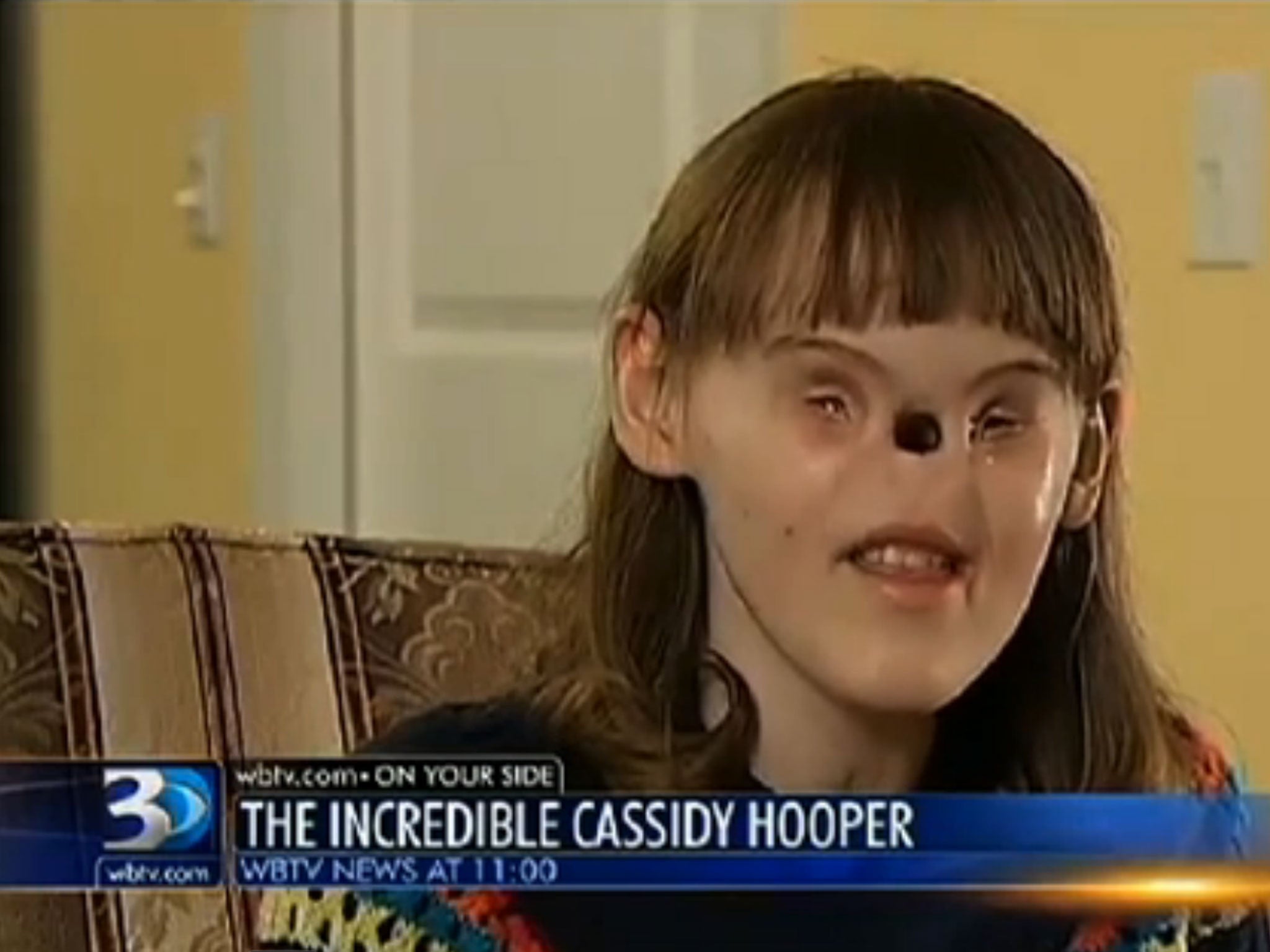 Cassidy Hooper talks to WBTV about her operation to construct a nose