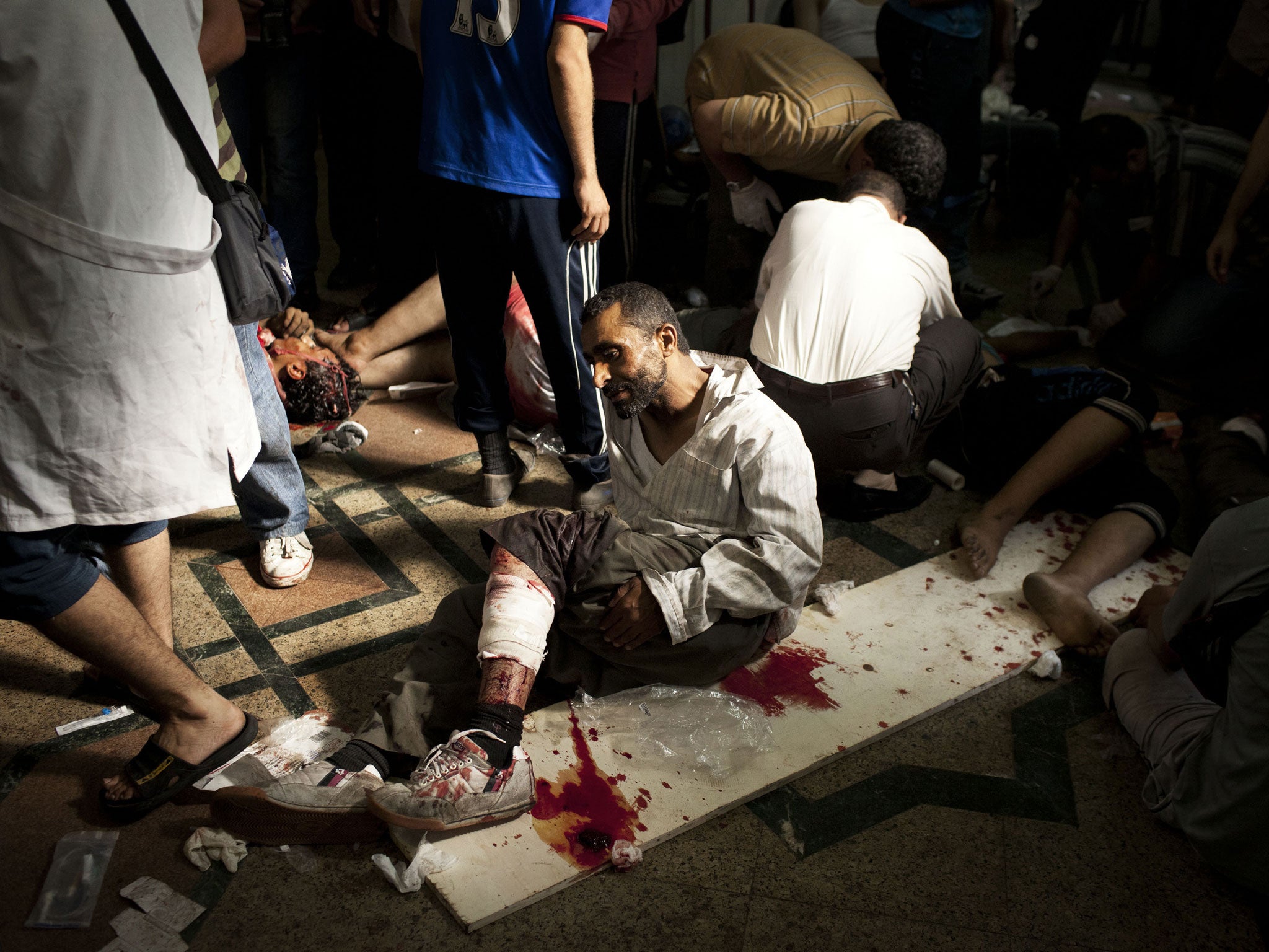 A wounded Morsi supporter