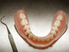 Scientists grow human tooth using stem cells