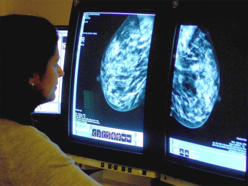 A consultant analyzes a mammogram