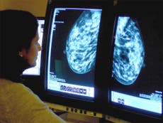 Almost 1m women not able to attend NHS breast screenings amid pandemic