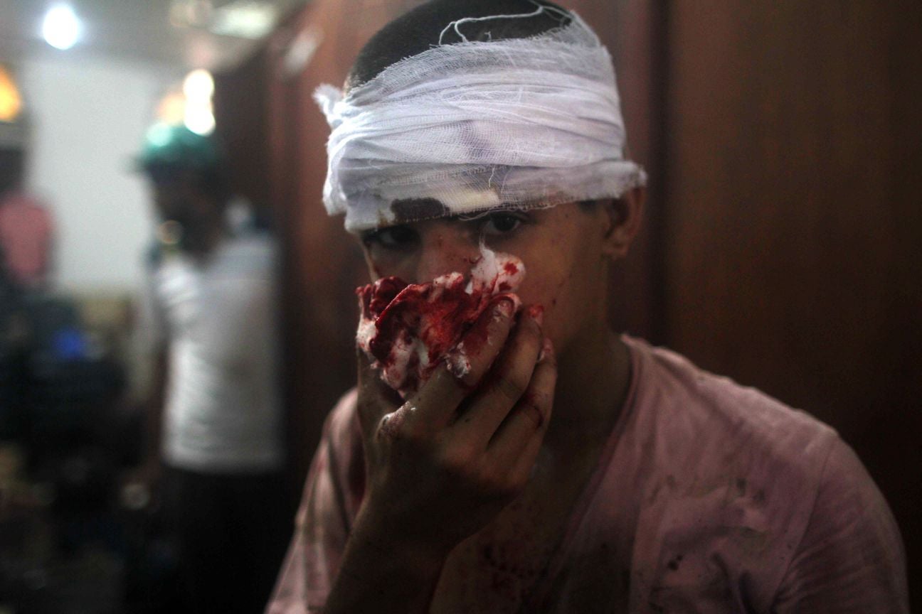 An injured Egyptian youth is seen at a makeshift hospital during clashes between supporters of Egypt's ousted president Mohamed Morsi and police in Cairo on August 14, 2013