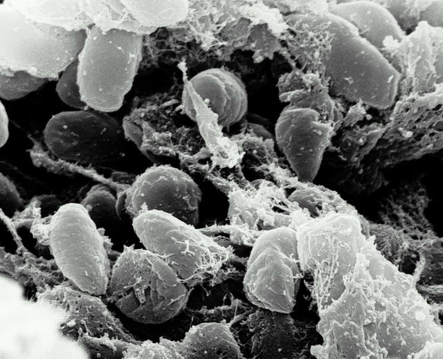 A 15-year-old Kyrgyzstani herder has died of bubonic plague after being bitten by a flea – the first case of Black Death in the country for over 30 years.